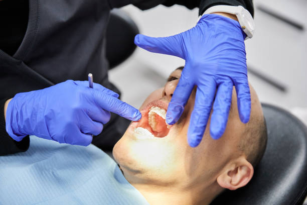 Best Emergency Treatment for Toothache in Chattahoochee Hills, GA